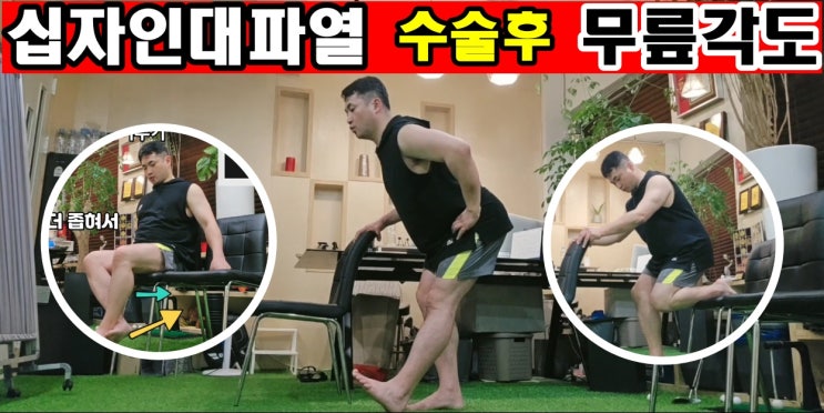  십자인대파열 수술후 무릎각도 늘리기 운동재활