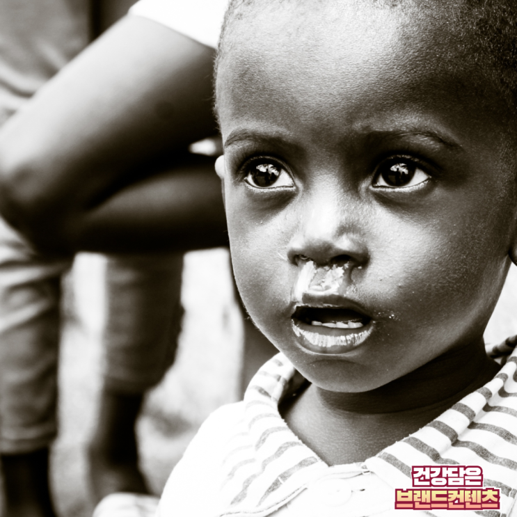  학질(말라리아) 증상, 원인, 치료법 및 예방법