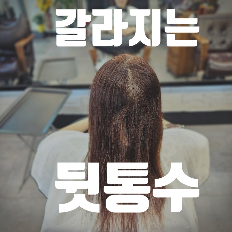  40대 여성 가르마탈모, 모류교정 링거펌으로 자연스러운 커버