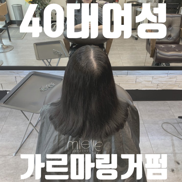  40대 여성 갈라지는 가르마,가르마탈모와 뿌리볼륨 링거펌으로 해결