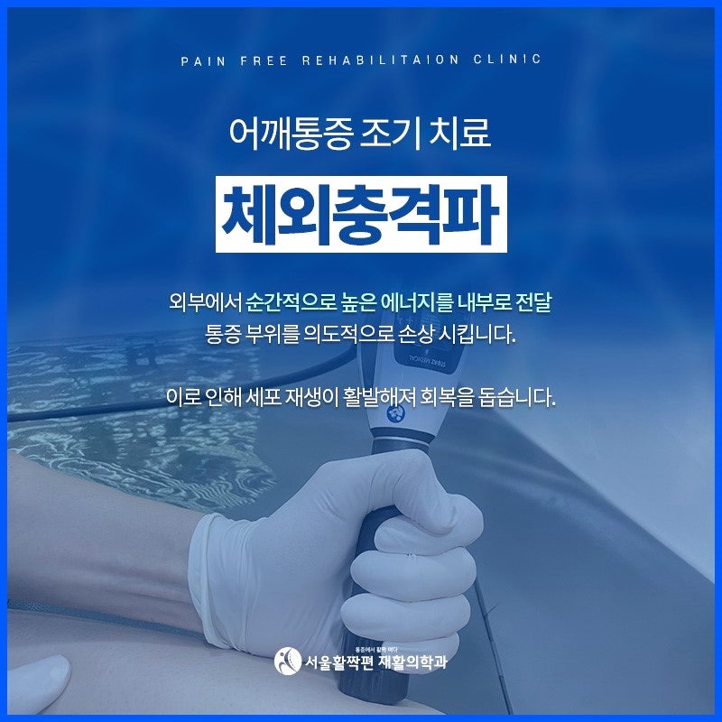 어깨통증의 원인과 치료 — 본문 그림