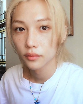 <b>스키즈 필릭스</b>, 교통사고로 팔 골절상 ‘팬미팅 불참’... 