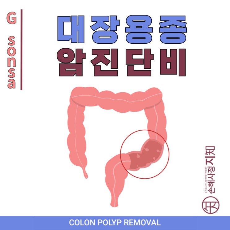  대장용종 D12.6 vs D01 – 보험금 차이, 이렇게 결정됩니다! - [암진단비, 1부]