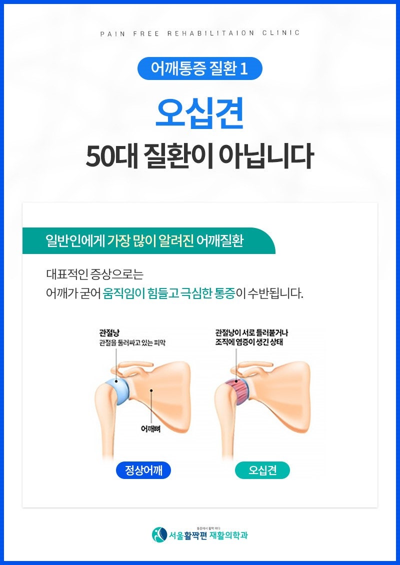 어깨통증의 원인과 치료 — 본문 그림
