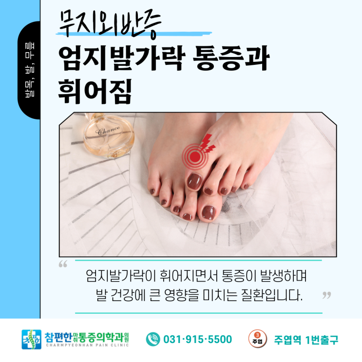  일산 정형외과 엄지발가락 통증과 휘어짐 -무지외반증