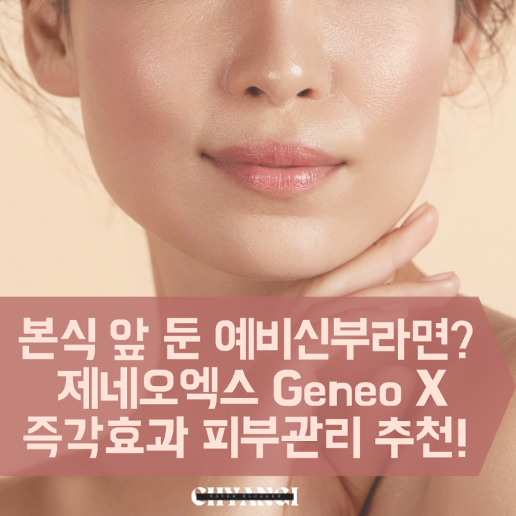  예신 신부관리 피부과 시술 [제네오엑스 Geneo X] 즉각효과 피부관리 후기
