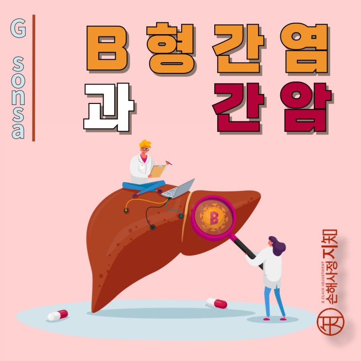  B형간염과 간암 – 과로와 스트레스, 인과관계 인정될까? -[판례, BoDa]