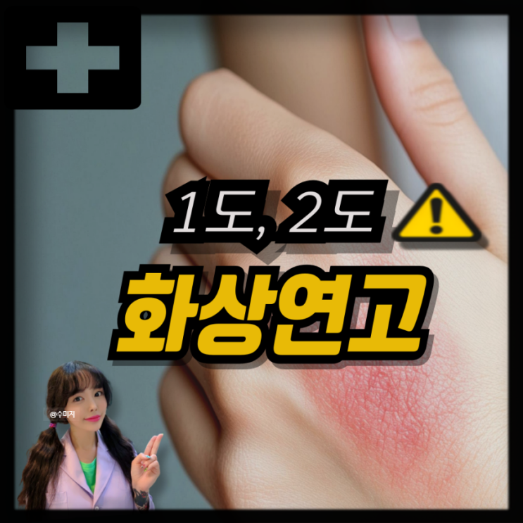  저온화상 물집 증상 화상 응급처치 화상연고