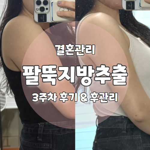  W6. 팔뚝 지방추출주사 3주 후기 후관리 뭉침, 식단, 붓기 멍 공개