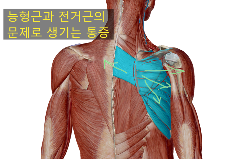 날개뼈 안쪽 통증 이유, 운동법 날개뼈 안쪽 통증 이유, 운동법