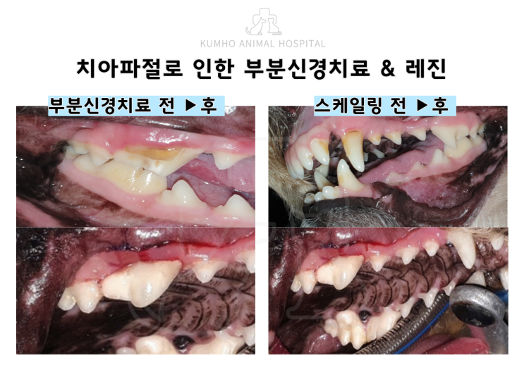  광주 강아지 치과 - 5살 강아지의 어금니 치아파절(치아골절)로 인한 부분 신경치료 후 레진치료 Case[광주 치과 동물병원, 강아지 치아파절, 강아지 신경치료, 강아지 레진]