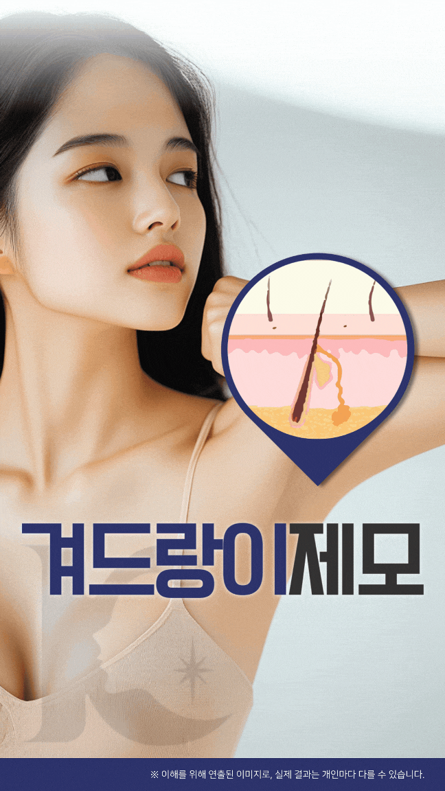  광주겨드랑이제모 수완지구에서 알려드리는 전신 제모의 포인트는