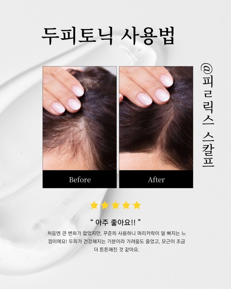  발모촉진을 위한 두피토닉 사용법, 올리브영 두피토닉 추천