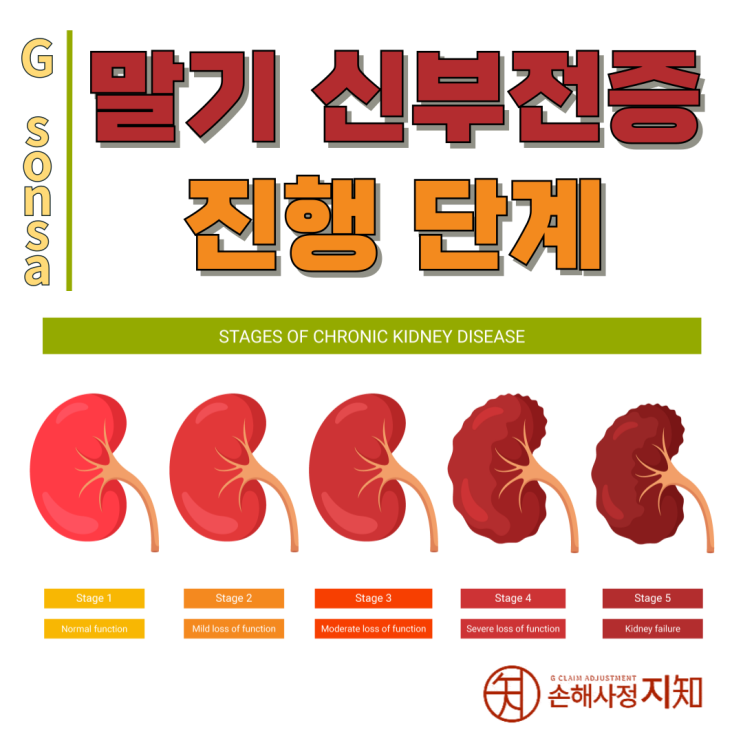  만성 신부전증 단계 – 내 신장은 지금 몇 단계일까요? - [신장질환, 3부]