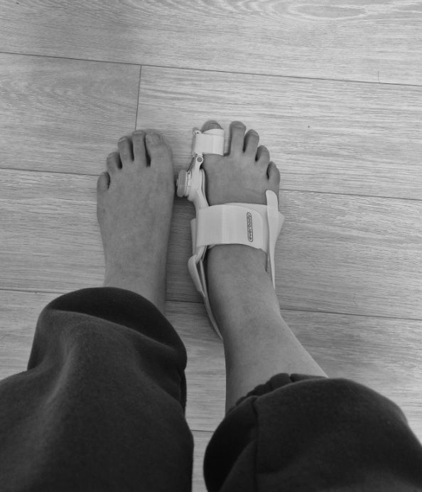 엄마선물추천 에버바디 발가락교정기 PRO 엄마선물추천 에버바디 발가락교정기 PRO