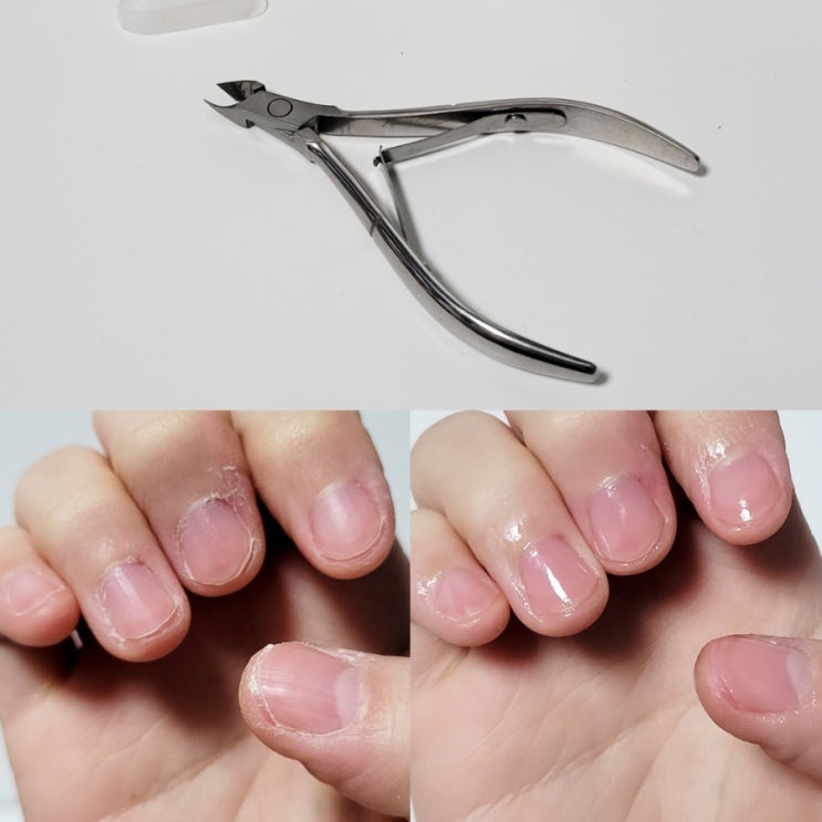  쉽게 큐티클제거 하는 방법 메툴리 네일 니퍼로 깔끔하게 손톱관리하기