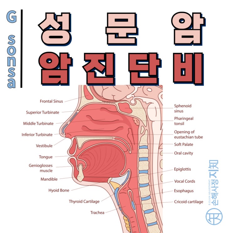  성문암(C32) – 보험금 받을 수 있을까? 제자리암 분쟁 주의하세요! - [엄마의질병, 1부]