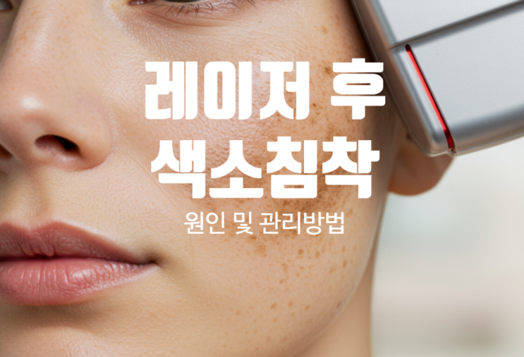  피코루비리팟 레이저 후 색소침착 원인 관리법 (의사 직접작성, 정보성 글)