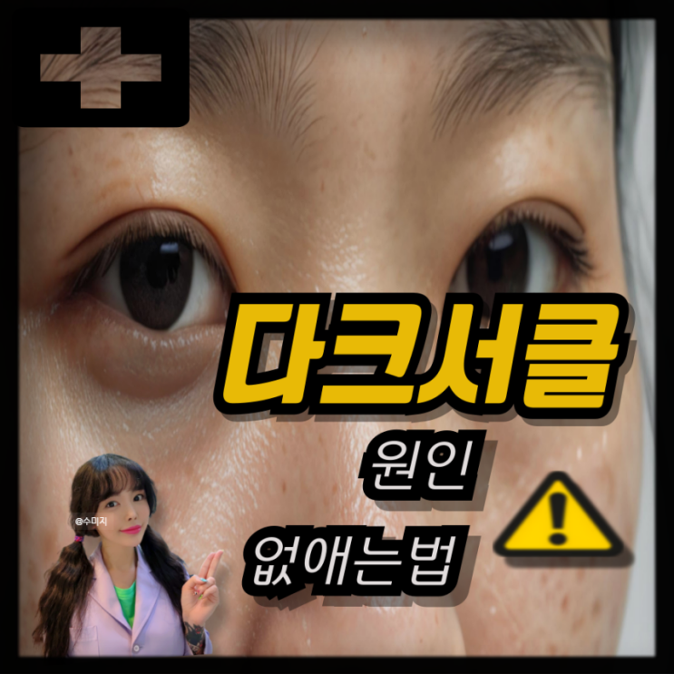 눈이멍든것처럼 보이는 다크써클 없애는법 다크서클 원인