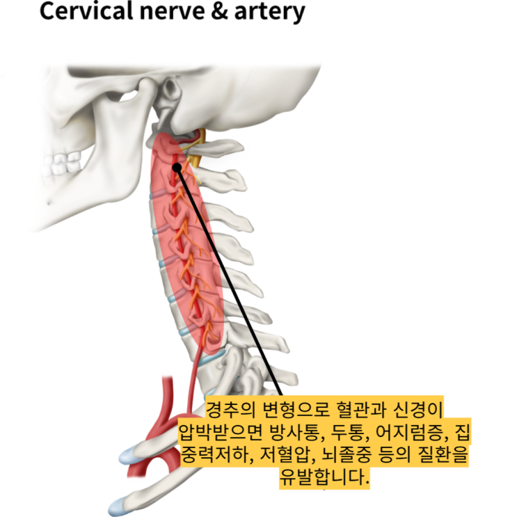  [부산 동래 기립성 빈맥증후군] 원인 모를 두통과 어지럼증, 어떻게 해야할까요?