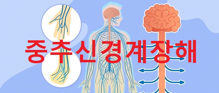  중추신경계 장해로 한쪽 팔이 마비된 경우 3급장해에 해당하는지 여부