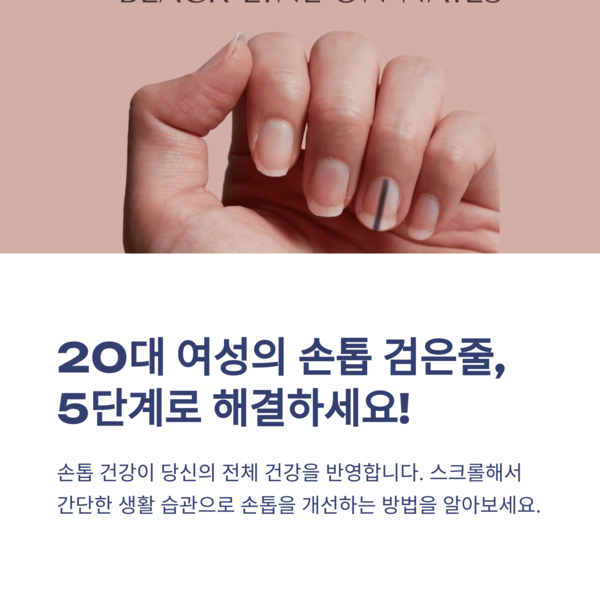  20대여성 손톱검은줄 5단계케어