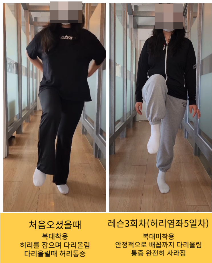  [서면 허리염좌] 허리삐끗 5일차, 레슨3회 후 얼마나 좋아졌을까?