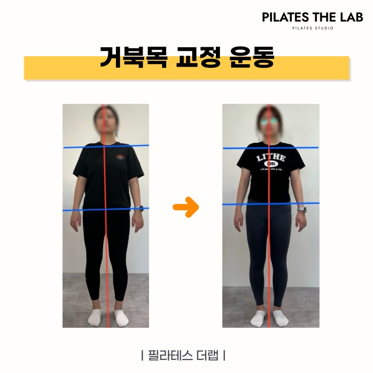  목동 필라테스 거북목 교정 필라테스, 효과적인 방법과 전후 변화!