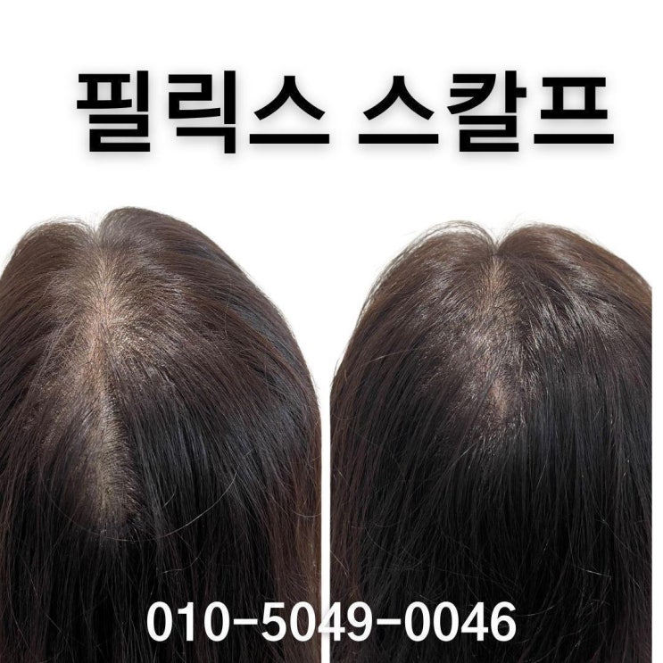  검단두피문신 전문가 인터뷰: Q&A 세션