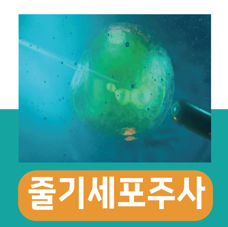  줄기세포주사가격, 무릎 피부 지방 주사 효과는? (실비)