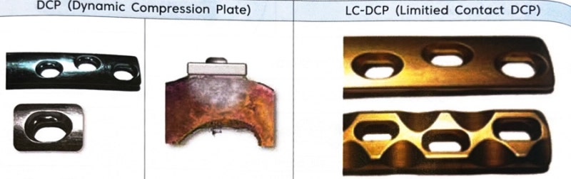 정형외과(OS) 수술실 Plate: Shape / Type / Function Part.1 : 네이버 블로그