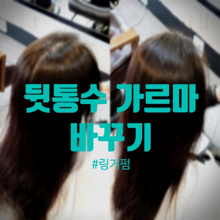  뒷통수 갈라짐 해결, 볼륨 살리는 링거펌 추천!