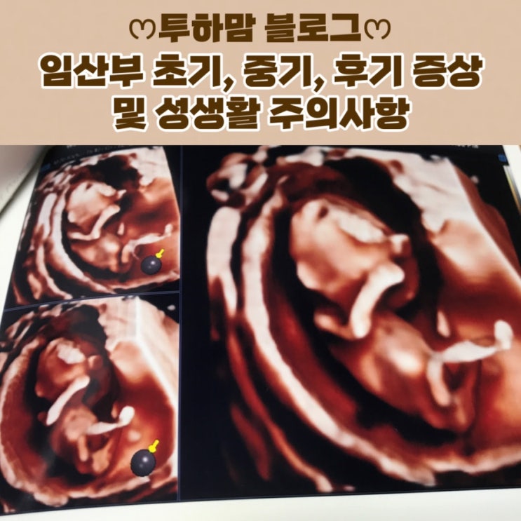  [임신 시기별 모든 것] 초기, 중기, 후기 증상과 성생활 주의사항