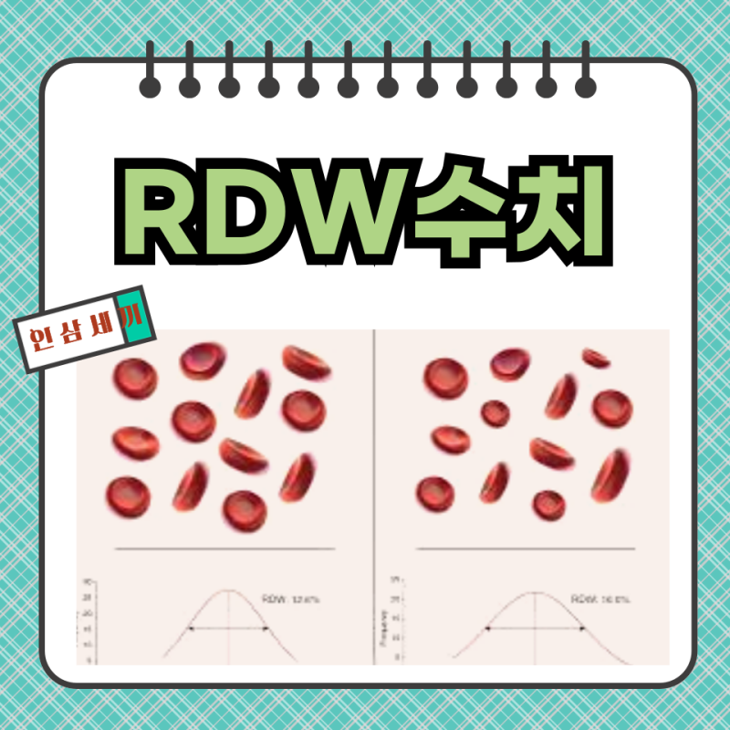 RDW수치 높거나 낮을 때 의미와 원인 해결법
