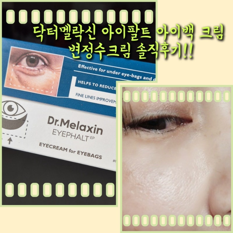 닥터멜락신 아이팔트 아이백 크림 변정수크림 솔직후기!!