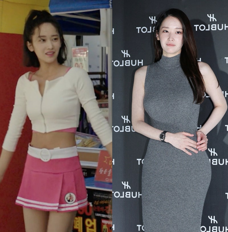 전종서 골반 전후 논란! 필러 시술 가격
