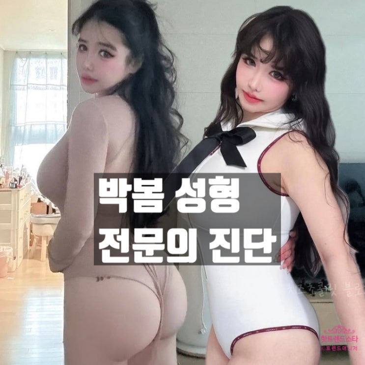  박봄 성형으로 보는 정신병 전문의 진단! 근황과 리즈시절 공개