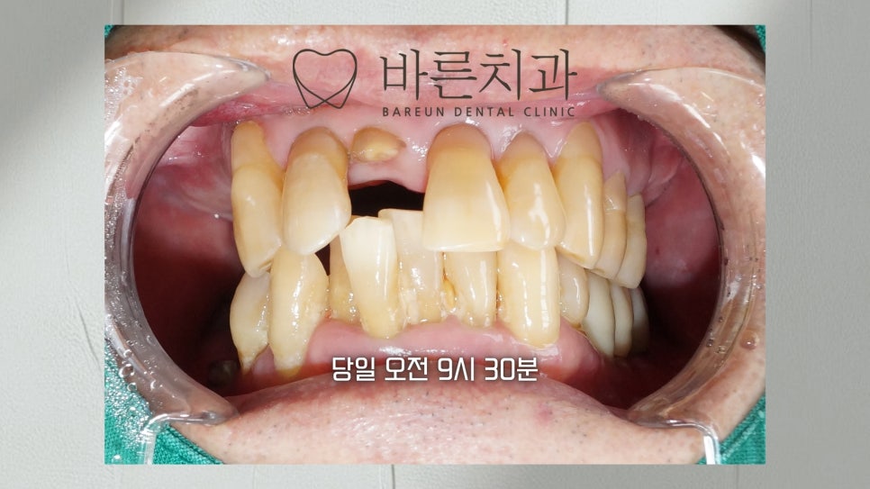 바른치과의원 사진 1