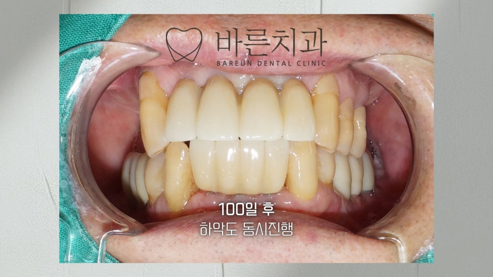 바른치과의원 사진 4