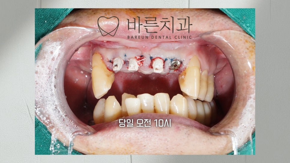 바른치과의원 사진 2