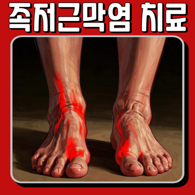 족저근막염 치료 및 예방법! 발바닥 통증 잡는 꿀팁 공개