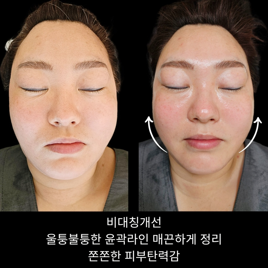 메르담 사진 1