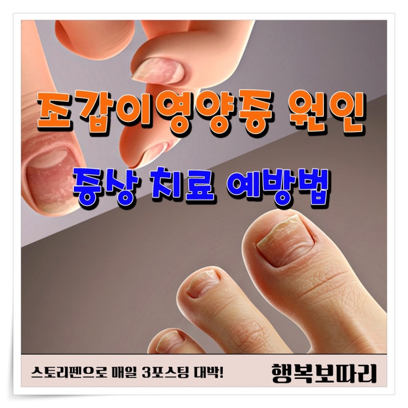조갑이영양증 원인 증상 치료 예방법