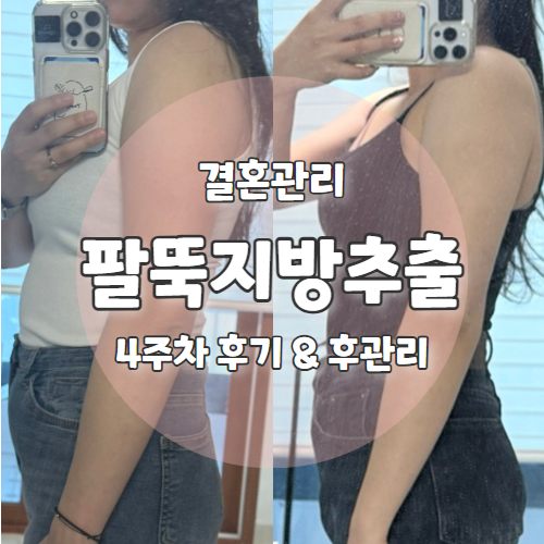  W6. 팔뚝 지방추출주사 시술주사 가격 4주차 후기 뭉침 및 관리 정보