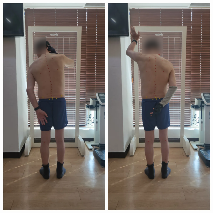  [동래 사직동 어깨충돌증후군] 만성 어깨통증, 낫지 않는 이유는?