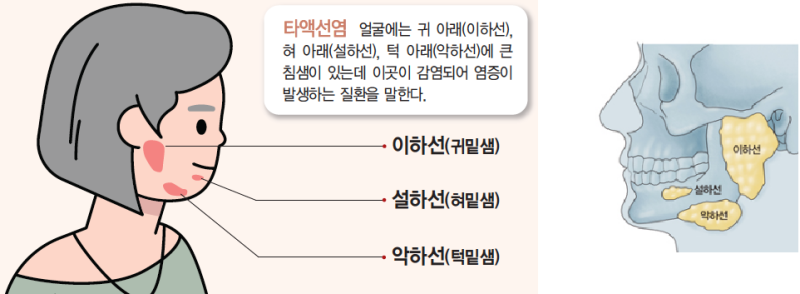 구강/침샘염