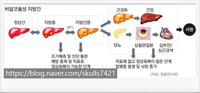 광주 유사나 헤파실 간 건강을 위한 똑똑한 실리마린 비오틴 밀크씨슬