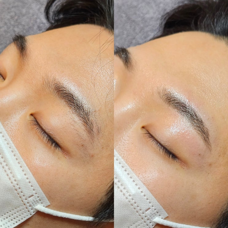  남자 눈썹 왁싱 비포, 애프터 사진으로 확인하세요. 영등포 남자 전문 관리샵 "청춘케어"