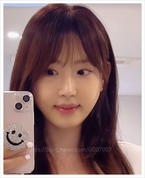  강예원 달라진 얼굴 성형 미모 앞트임 복원 이젠사랑할수있을까