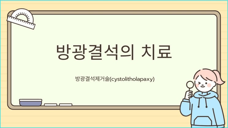  방광결석(Bladder stone)의 치료 방광결석제거술(cystolitholapaxy)에 대해 알아봐요!